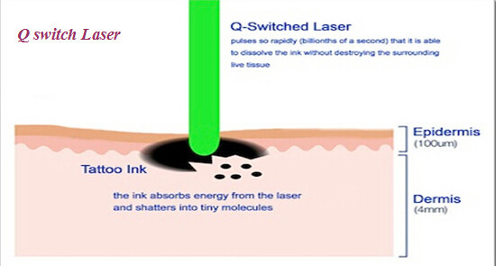 xglaser heiße Laser-Haarabbaumaschine Verkaufs 2014 schnelle